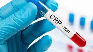 CRP  CReactive proteincrp test procedurewhat does c mean in crpdrnajeebviralhealthscience [upl. by Nikolaos7]