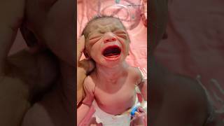 Newborn baby crying after birthnewborncarenewbornbabybornebabynewborn [upl. by Patnode]