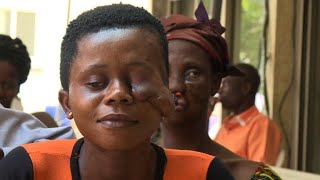 Hope for noma disease victims left disfigured in ICoast [upl. by Inahet103]