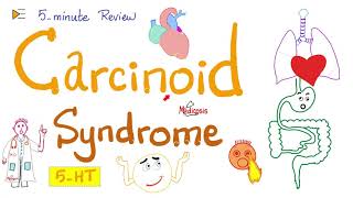 Carcinoid Syndrome  SerotoninSecreting Tumors  5Minute Review 🖐 [upl. by Gerc]