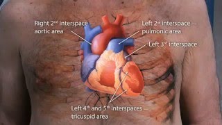 Macleods Physical Examination Of The Cardiovascular System OSCE Guide 2016 [upl. by White]