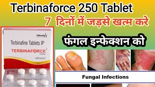 Terbinaforce Tablet Terbinafine 250mg Tablet Antifungal Tablet Fungal Infection Treatment [upl. by Aigroeg]