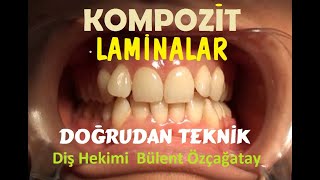 Kompozit Lamina 132 Doğrudan Teknik [upl. by Goldstein]