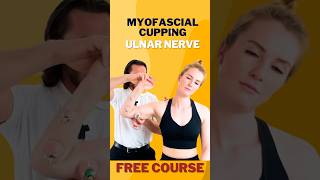 How To Use Myofascial Cupping Ulnar Nerve cupping therapy manualtherapy arm shortsfeed [upl. by Tallbott714]