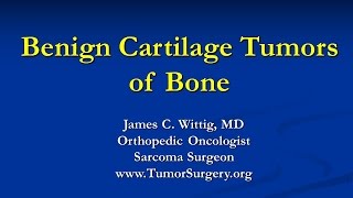 Orthopedic Oncology Course  Benign Cartilage Tumors Osteochondroma Chondroblastoma  Lecture 5 [upl. by Kreager701]