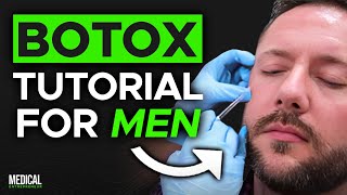 Botox Injection Patterns for Men  Full Procedure Demonstration [upl. by Rotciv]