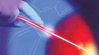 Krampfadern mit Laser behandeln [upl. by Tate]