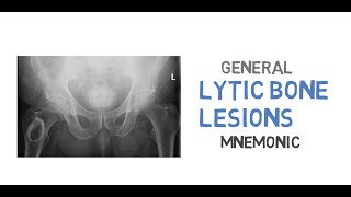 What are the differentials for lytic bone lesions [upl. by Bringhurst]