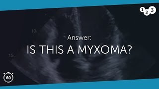 60 Seconds of Echo Teaching Answer Is this a myxoma [upl. by Noyr118]