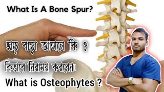 হাড় বাড়া আসলে কি  What is Osteophytes What is Bone spur [upl. by Klehm748]