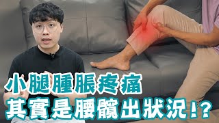 整天坐著很少走，小腿卻莫名腫脹成蘿蔔腿！？ [upl. by Hulda]