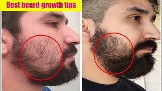 Fix Patchy Beard Permanently amp Grow Faster [upl. by Nosnor]