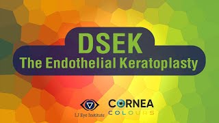 Cornea Colours  DSEK The Endothelial Keratoplasty [upl. by Illehs]