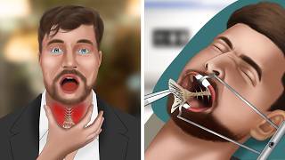 ASMR Animation Remove fish bones stuck in MrBeasts throat [upl. by Eentihw]