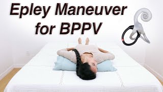 Epley Maneuver to Treat BPPV Dizziness with DixHallpike to Determine Which Side [upl. by Llehcam]