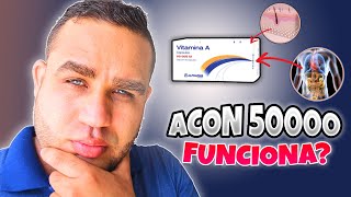 ACON 50000 VITAMINA A RETINOL PARA QUE SIRVE  DEBES SABER ESTO [upl. by Rhetta]