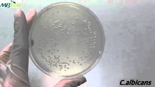 SDSabouraud Dextrose Agar [upl. by Orest623]