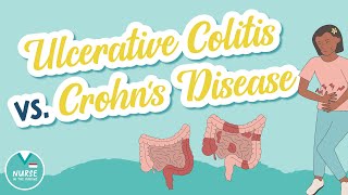 Ulcerative Colitis vs Crohns Disease  Know the Difference  Med Surg Help for Nursing School [upl. by Absalom]