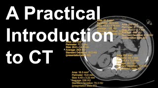 A Practical Introduction to CT [upl. by Cimah]