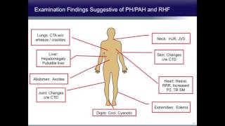 Pulmonary Arterial Hypertension Diagnosis Classifications and Therapy [upl. by Bathelda]