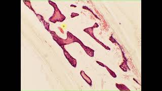 Intramembranous ossification cancellous spongy bone flatbone skull [upl. by Narhet60]