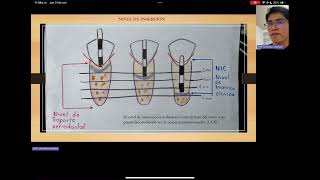 Métodos de diagnóstico periodontales [upl. by Afital]