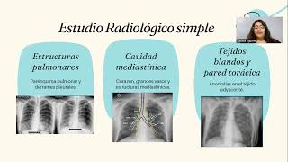 RADIODIAGNOSTICO DE TORAX  DIAGNOSTICO POR IMAGENES [upl. by Iona]