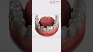 Best Aligner Orthodontic Without braces treatment at Bengaluru  Richardsons [upl. by Llien]