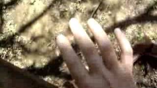 YouTube clonus hand tremor [upl. by Aetnahs694]