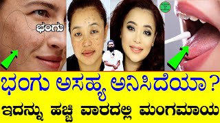 Home Remedies for Pigmentation  Bhangu on Face Kannada  Pigmentation Cream  Glowing Skin [upl. by Grubman405]