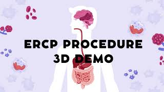 ERCP procedure 3d DEMO ERCP MedicalProcedure Gastroenterology [upl. by Egief]