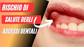 Ascesso dentale cause sintomi e trattamenti essenziali [upl. by Nesaj256]