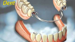 Dental Education Tooth Replacement Options [upl. by Clarke]