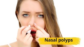 Nasal polyps Causes symptoms and treatments [upl. by Trawets]