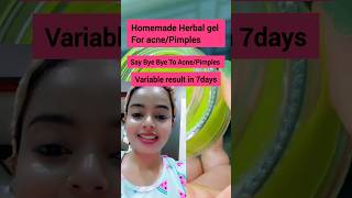 Herbal Anti Pimple Gel  Remove AcnePimples in 7days result 😱shortsfeed shorts shortsvideo acne [upl. by Einhpad468]