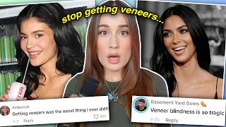 VENEERS ARE RUINING YOUR LIFE scientifically proven [upl. by Tani385]