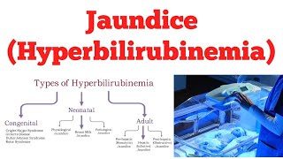 Jaundice Acquired Hyperbilirubinemia Types Causes and Differentiation  Biochemistry  NEET PG [upl. by Arleta]