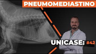 UNICASE 42  Pneumomediastino [upl. by Aihseken]