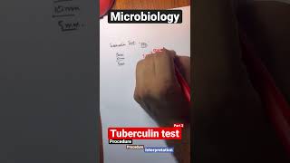 mantoux testTUBERCULIN TEST mantoux test positive mantoux test in hindi mantoux test in hindi [upl. by Lau469]