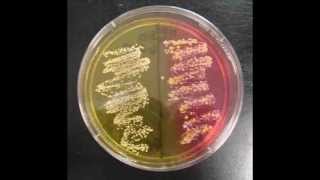 How to Interpret Mannitol Salt Agar Bacterial Growth Medium [upl. by Benildas414]