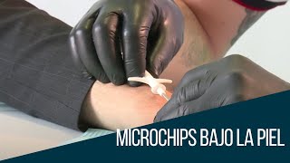 Conozca porqué personas en todo el mundo se están implantando microchips [upl. by Ecirum]