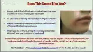 Angular Cheilitis Scars  Angular Cheilitis Treatment [upl. by Enrobyalc627]