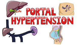 Portal Hypertension  Causes of Portal Hypertension PreIntraPost Hepatic  Symptoms amp Diagnosis [upl. by Neehsas]