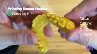 Printing Dental Models with Bambu Lab P1P [upl. by Astrix744]