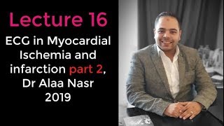 ECG from A to Z 016Alaa nasr2019 myocardial ischemia and infarction part 2 [upl. by Meta]