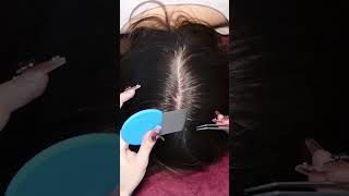 ASMR School Nurse LICE Removal with NAILS and Tweezers Real Person asmr shorts short [upl. by Vasya]