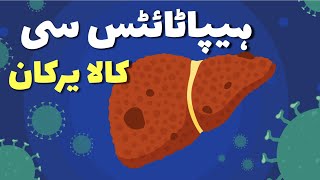 Hepatitis C URDU ہیپاٹائٹس سی [upl. by Arley]