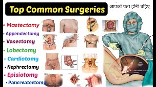 Top 15 Common Surgeries  You Should Know  mastectomy Appendectomy Lobectomyamp More [upl. by Salchunas]