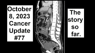 CU77 The story so far to Oct 8 2023 [upl. by Belldame]