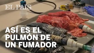 Así se transforma el pulmón de un fumador [upl. by Kentigerma]